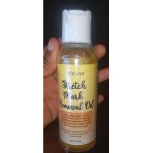 MOOYAM Stretch Mark Removal Oil (Mooyam) X1